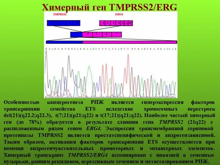 Химерный ген TMPRSS2/ERG Особенностью канцерогенеза РПЖ является гиперэкспрессия факторов транскрипции