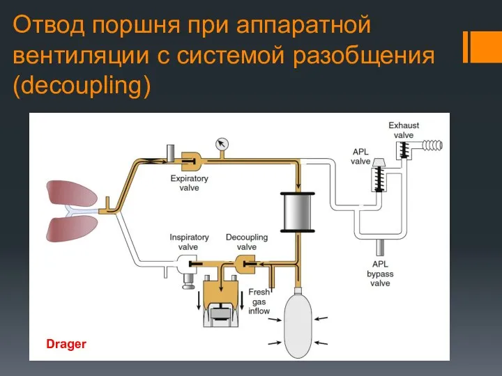 Отвод поршня при аппаратной вентиляции с системой разобщения (decoupling) Drager