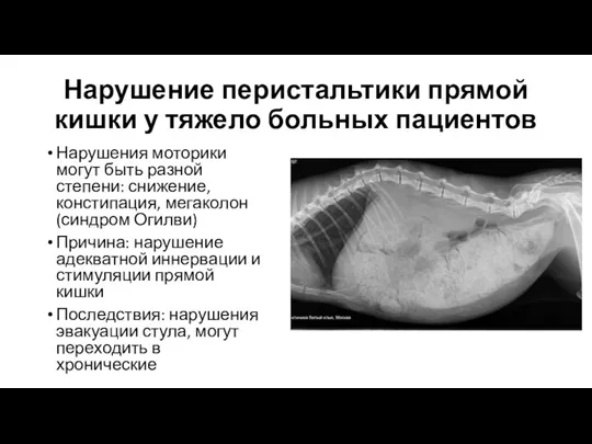 Нарушение перистальтики прямой кишки у тяжело больных пациентов Нарушения моторики могут быть разной