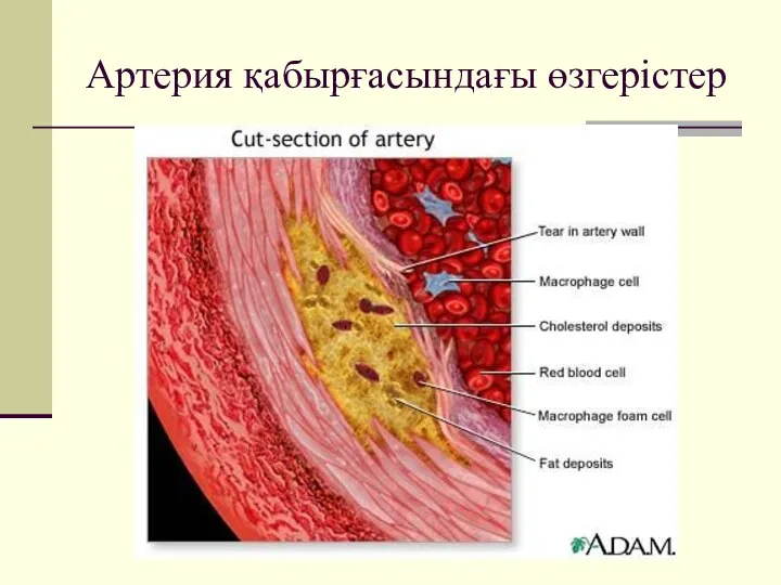 Артерия қабырғасындағы өзгерістер