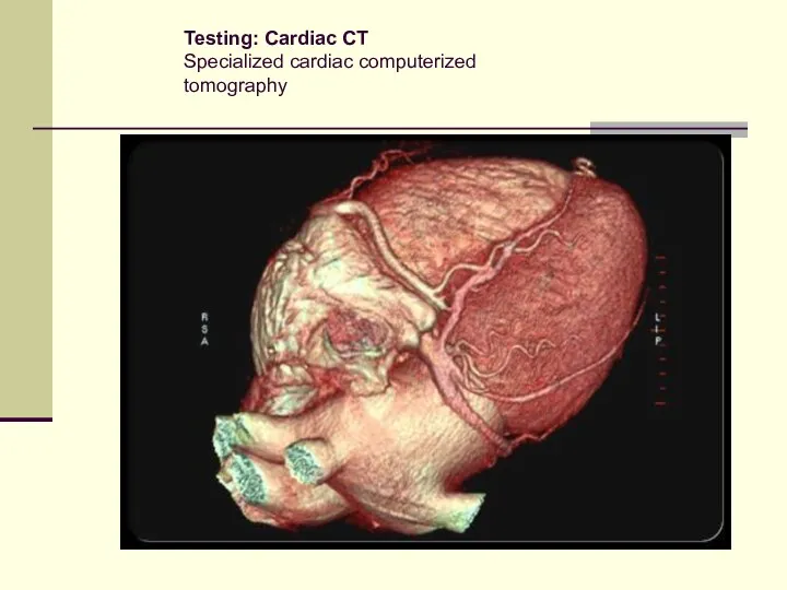 Testing: Cardiac CT Specialized cardiac computerized tomography