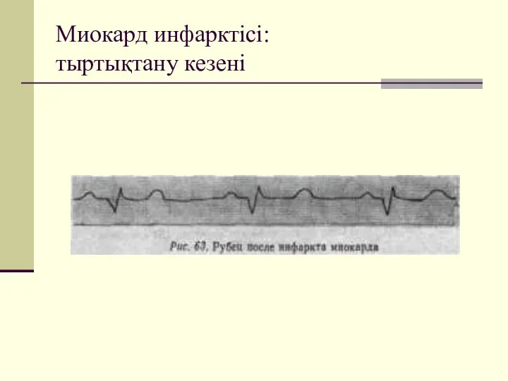 Миокард инфарктісі: тыртықтану кезені