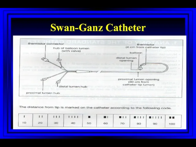 Swan-Ganz Catheter