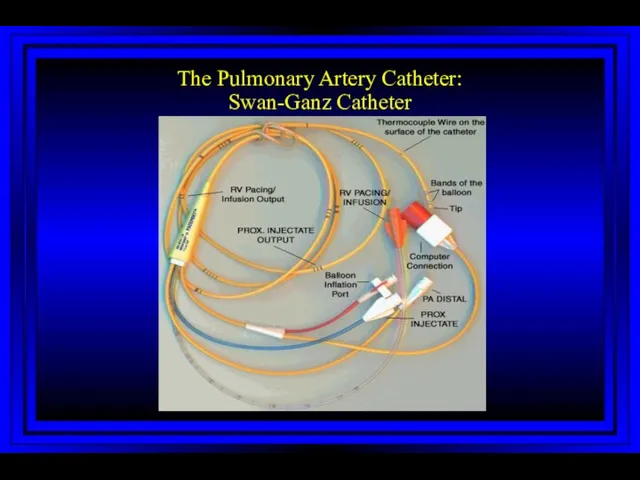 The Pulmonary Artery Catheter: Swan-Ganz Catheter