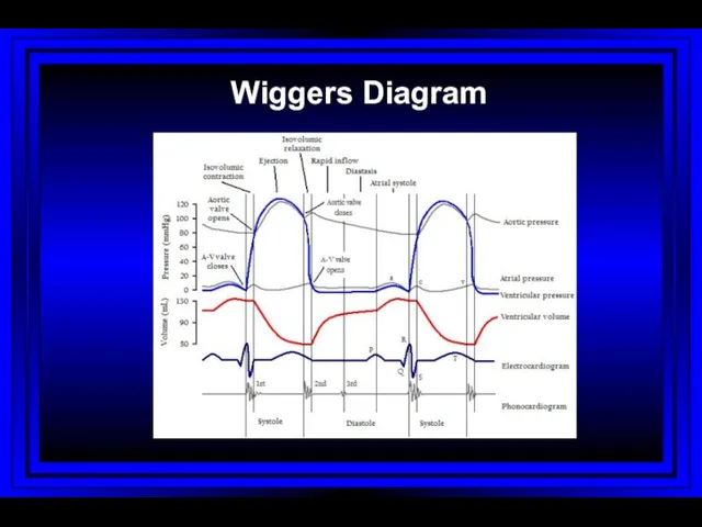 Wiggers Diagram