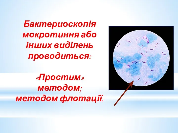 Бактериоскопія мокротиння або інших виділень проводиться: «Простим» методом; методом флотації.