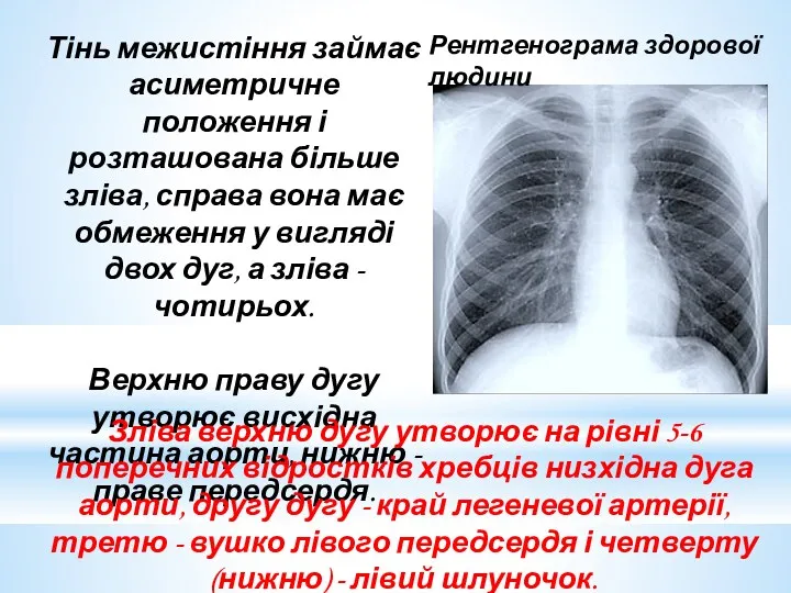 Тінь межистіння займає асиметричне положення і розташована більше зліва, справа