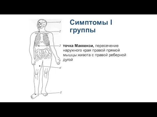 Симптомы I группы точка Маккензи, пересечение наружного края правой прямой мышцы живота с правой реберной дугой