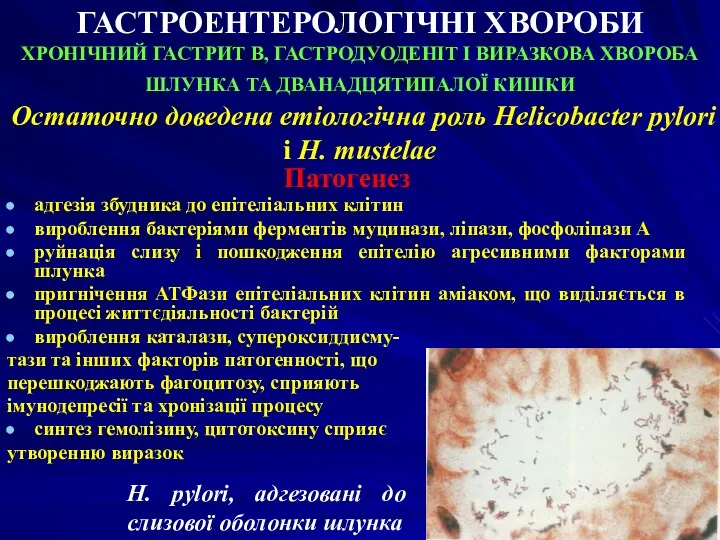 ГАСТРОЕНТЕРОЛОГІЧНІ ХВОРОБИ ХРОНІЧНИЙ ГАСТРИТ В, ГАСТРОДУОДЕНІТ І ВИРАЗКОВА ХВОРОБА ШЛУНКА ТА ДВАНАДЦЯТИПАЛОЇ КИШКИ