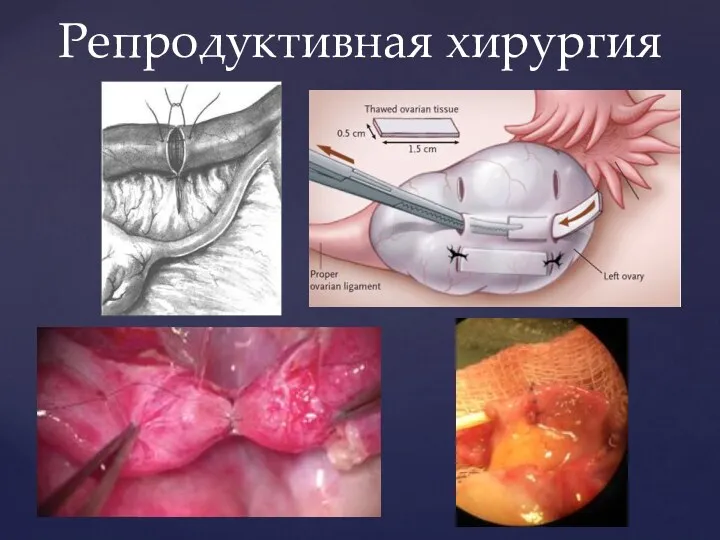 Репродуктивная хирургия