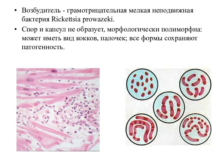 Возбудитель - грамотрицательная мелкая неподвижная бактерия Rickettsia prowazeki. Спор и