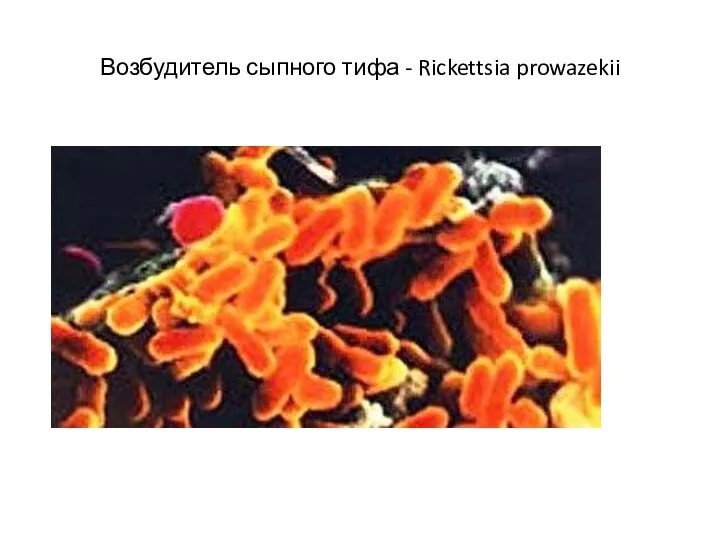 Возбудитель сыпного тифа - Rickettsia prowazekii