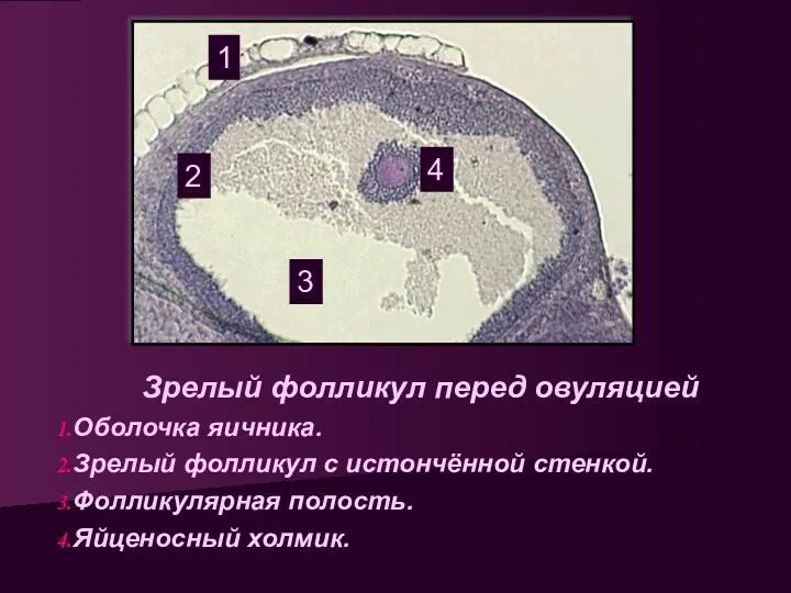 Зрелый фолликул перед овуляцией Оболочка яичника. Зрелый фолликул с истончённой