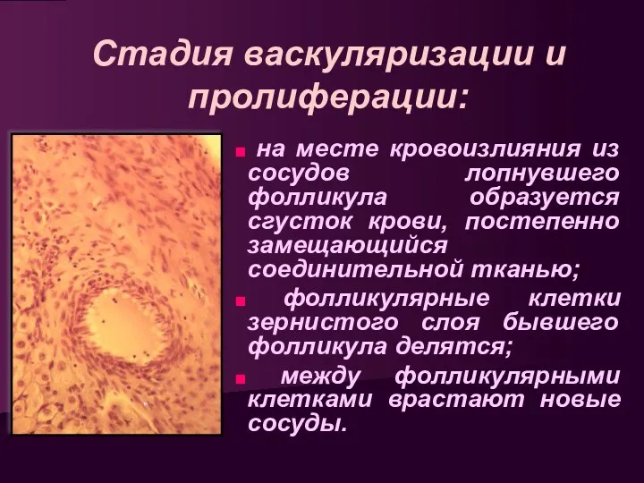 Стадия васкуляризации и пролиферации: на месте кровоизлияния из сосудов лопнувшего