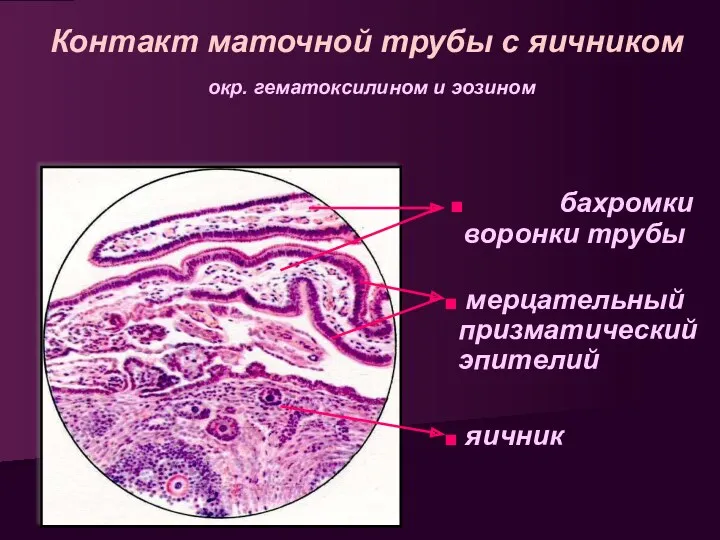 Контакт маточной трубы с яичником окр. гематоксилином и эозином бахромки воронки трубы мерцательный призматический эпителий яичник