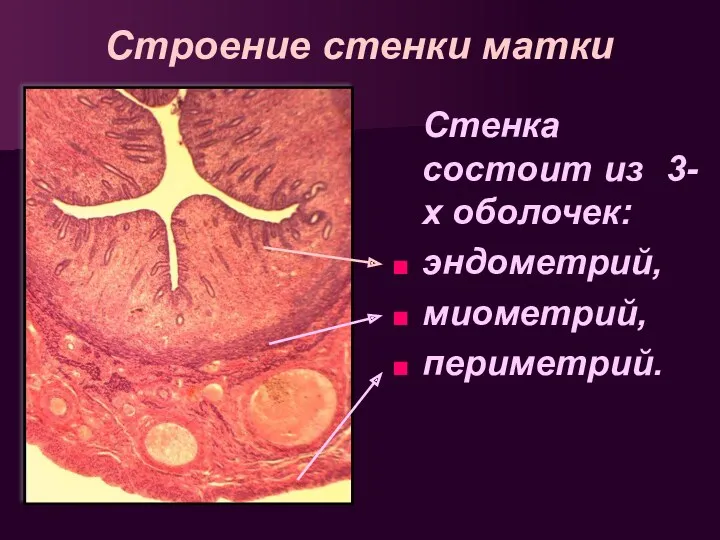 Строение стенки матки Стенка состоит из 3-х оболочек: эндометрий, миометрий, периметрий.