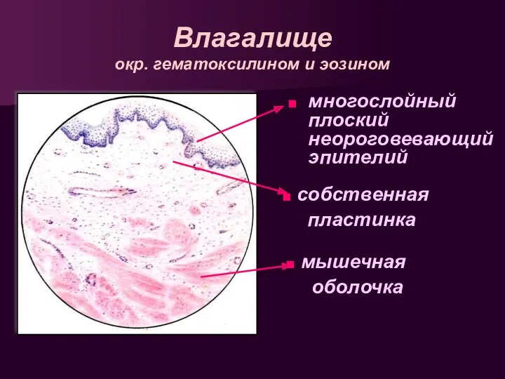 Влагалище окр. гематоксилином и эозином многослойный плоский неороговевающий эпителий собственная пластинка мышечная оболочка