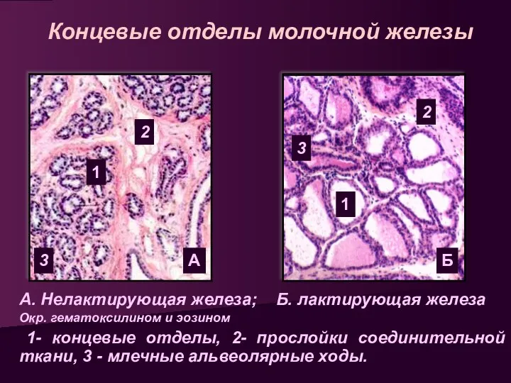 Концевые отделы молочной железы А. Нелактирующая железа; Б. лактирующая железа