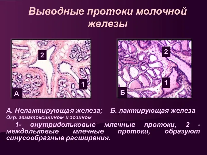 Выводные протоки молочной железы А. Нелактирующая железа; Б. лактирующая железа