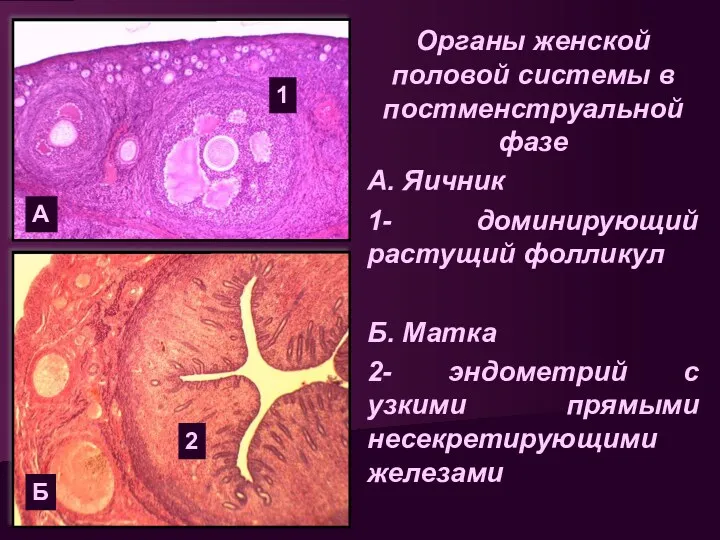 Органы женской половой системы в постменструальной фазе А. Яичник 1-