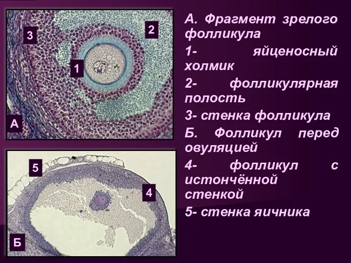 А. Фрагмент зрелого фолликула 1- яйценосный холмик 2- фолликулярная полость