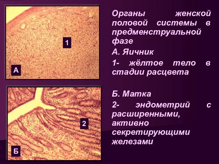 Органы женской половой системы в предменструальной фазе А. Яичник 1-