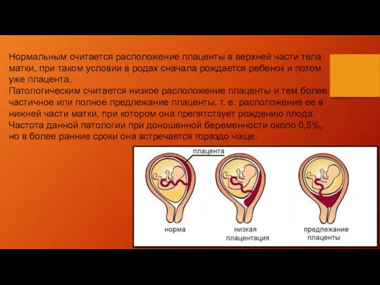 Нормальным считается расположение плаценты в верхней части тела матки, при таком условии в
