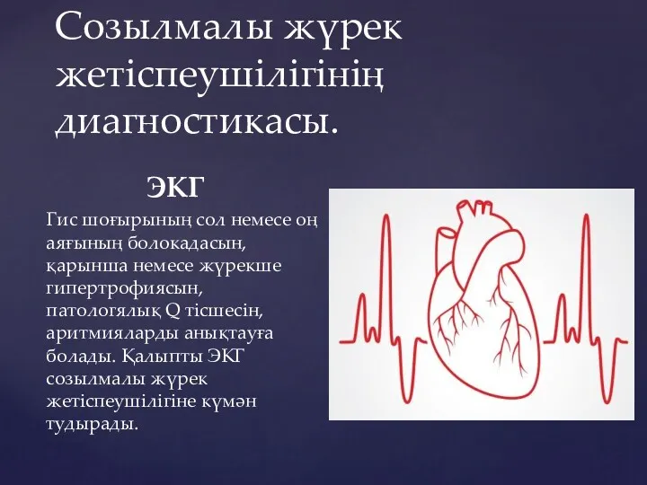 Созылмалы жүрек жетіспеушілігінің диагностикасы. ЭКГ Гис шоғырының сол немесе оң