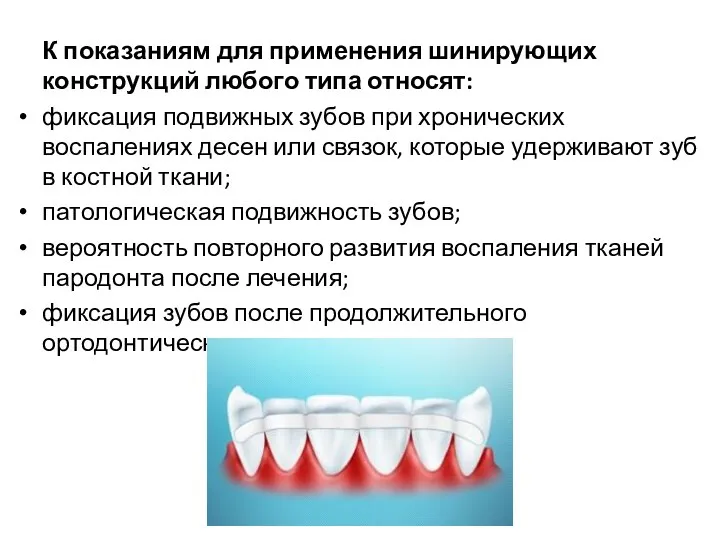 К показаниям для применения шинирующих конструкций любого типа относят: фиксация подвижных зубов при
