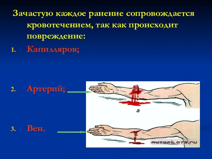 Зачастую каждое ранение сопровождается кровотечением, так как происходит повреждение: Капилляров; Артерий; Вен.