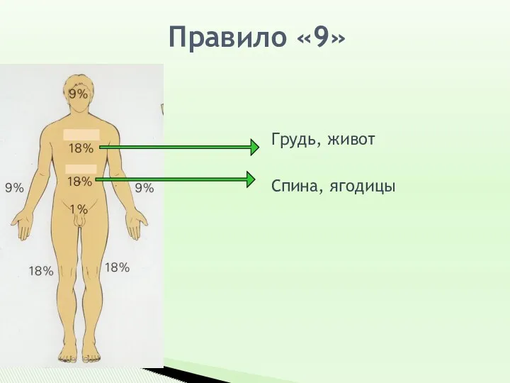 Правило «9» Грудь, живот Спина, ягодицы