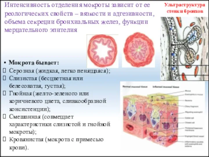 Ультраструктура стенки бронхов Интенсивность отделения мокроты зависит от ее реологических