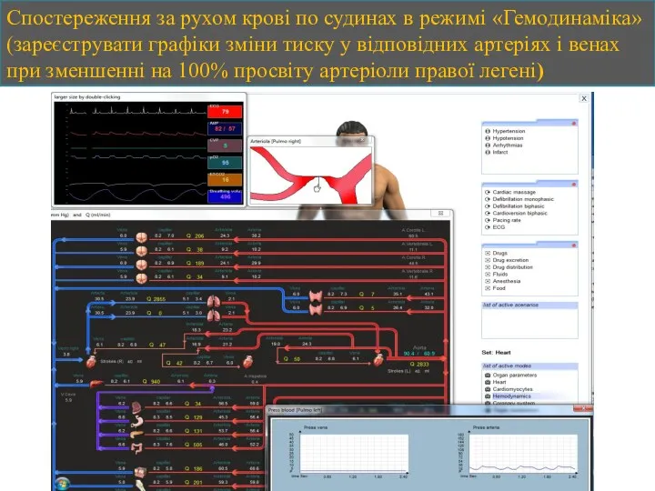 Спостереження за рухом крові по судинах в режимі «Гемодинаміка» (зареєструвати