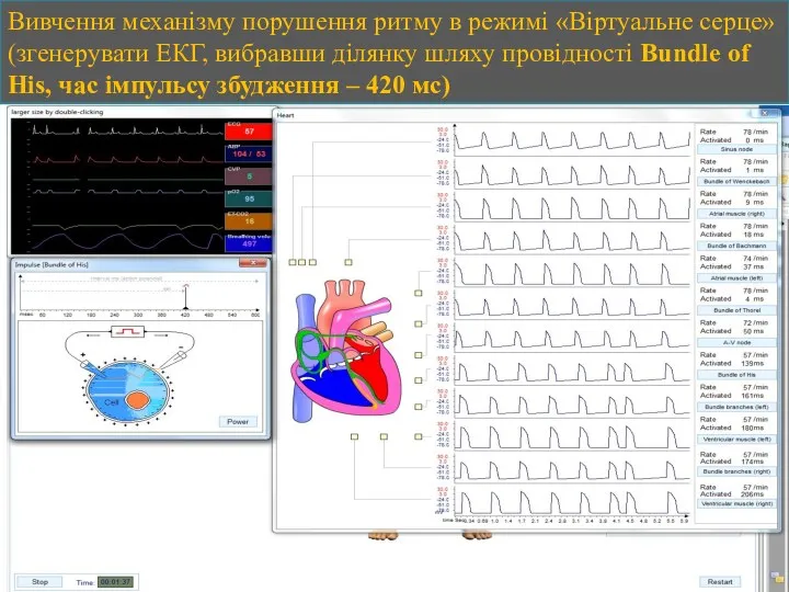Вивчення механізму порушення ритму в режимі «Віртуальне серце» (згенерувати ЕКГ,