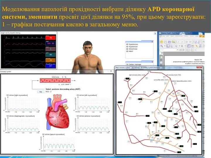 Моделювання патологій прохідності вибрати ділянку APD коронарної системи, зменшити просвіт