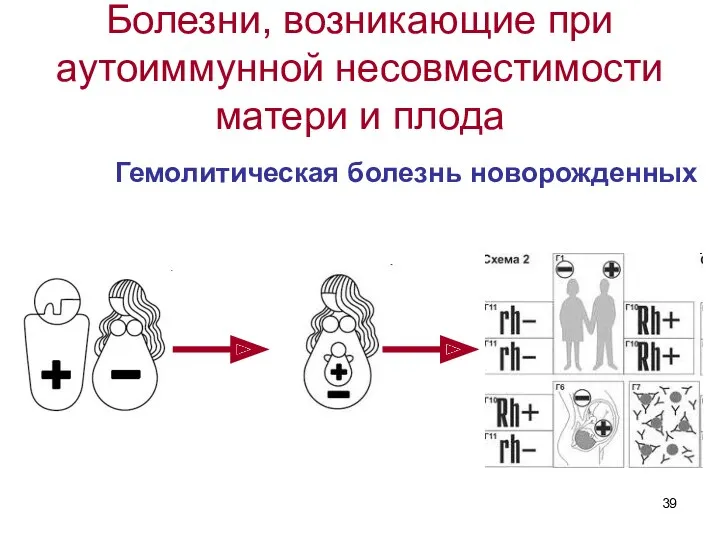 Болезни, возникающие при аутоиммунной несовместимости матери и плода Гемолитическая болезнь новорожденных