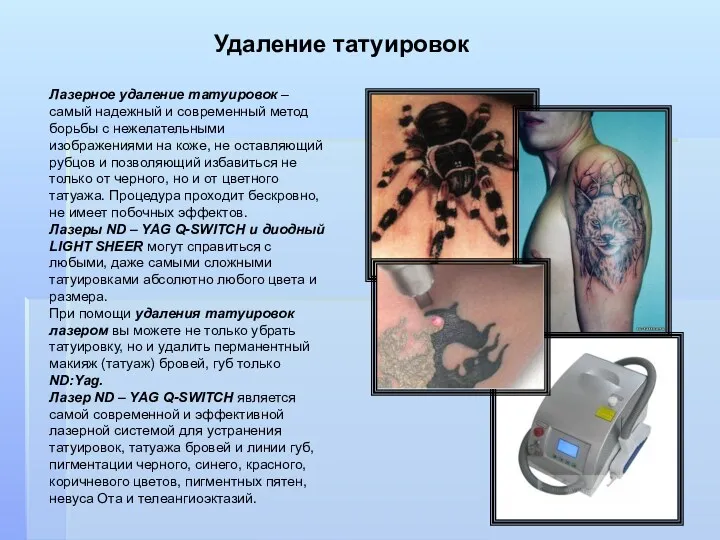 Удаление татуировок Лазерное удаление татуировок – самый надежный и современный метод борьбы с