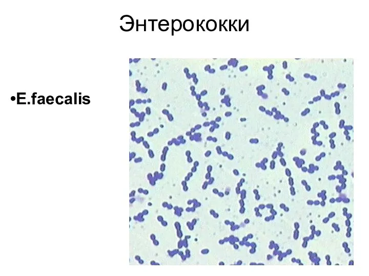 Энтерококки E.faecalis