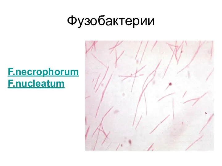 Фузобактерии F.necrophorum F.nucleatum