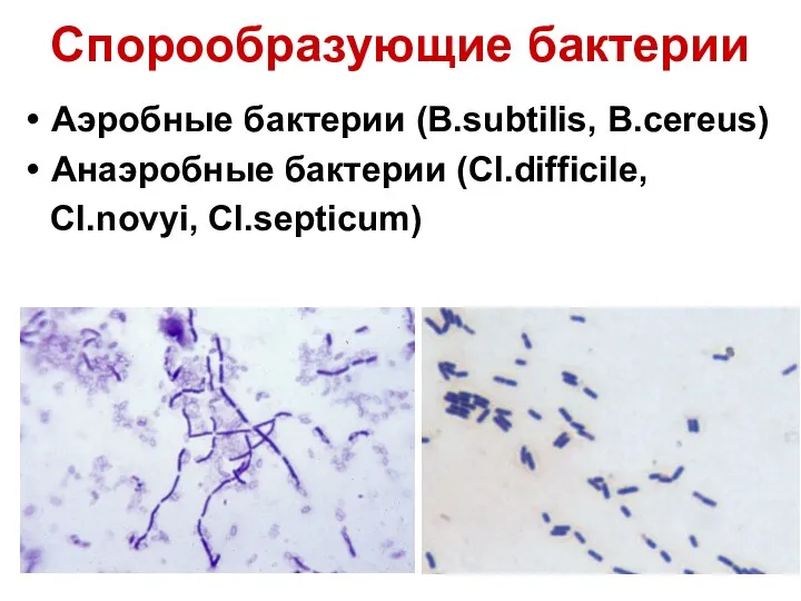 Спорообразующие бактерии Аэробные бактерии (B.subtilis, B.cereus) Анаэробные бактерии (Cl.difficile, Cl.novyi, Cl.septicum)