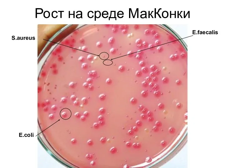 Рост на среде МакКонки E.coli S.aureus E.faecalis