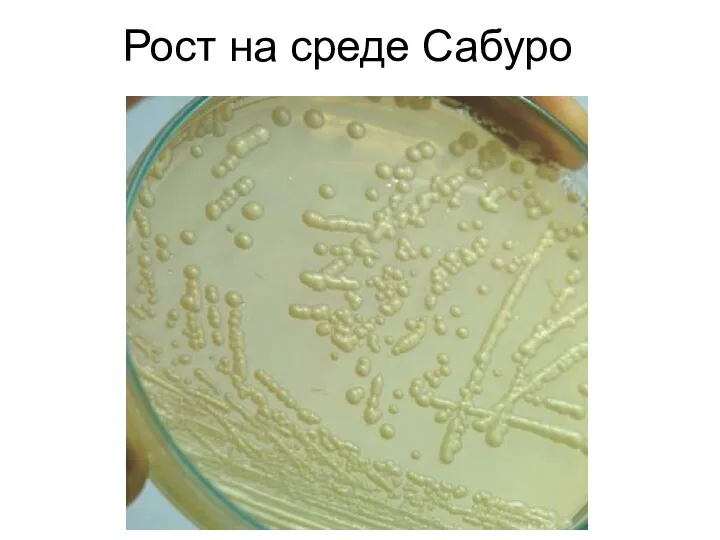 Рост на среде Сабуро