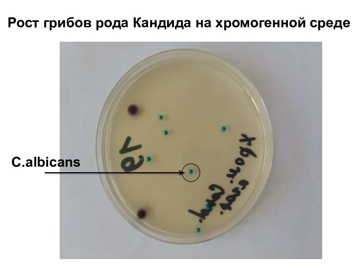 Рост грибов рода Кандида на хромогенной среде C.albicans