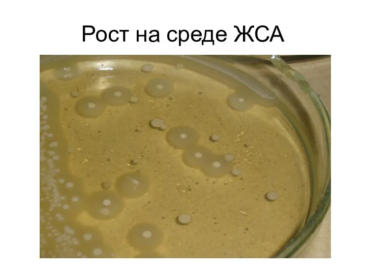 Рост на среде ЖСА