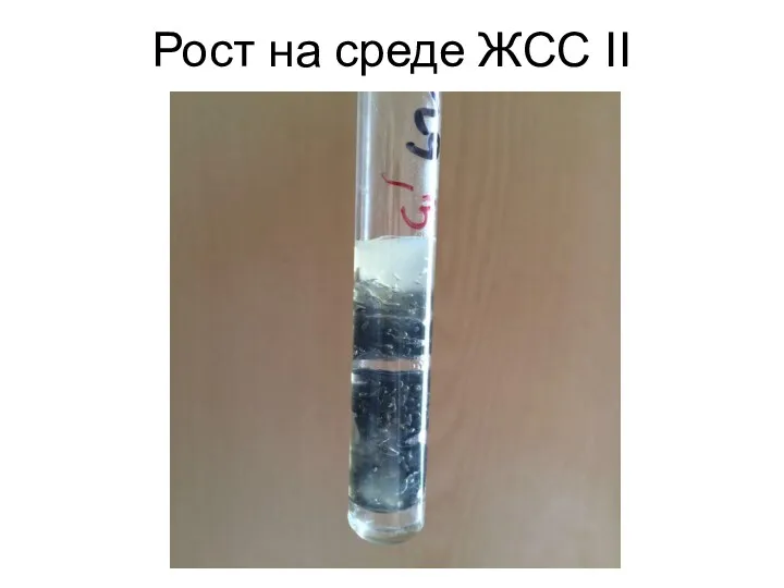 Рост на среде ЖСС II