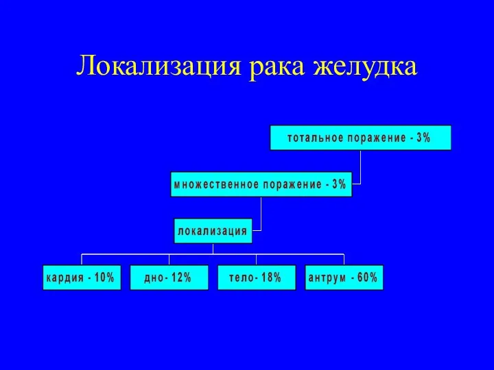 Локализация рака желудка