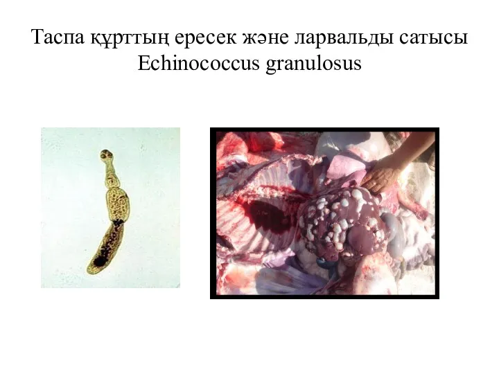 Таспа құрттың ересек және ларвальды сатысы Echinococcus granulosus