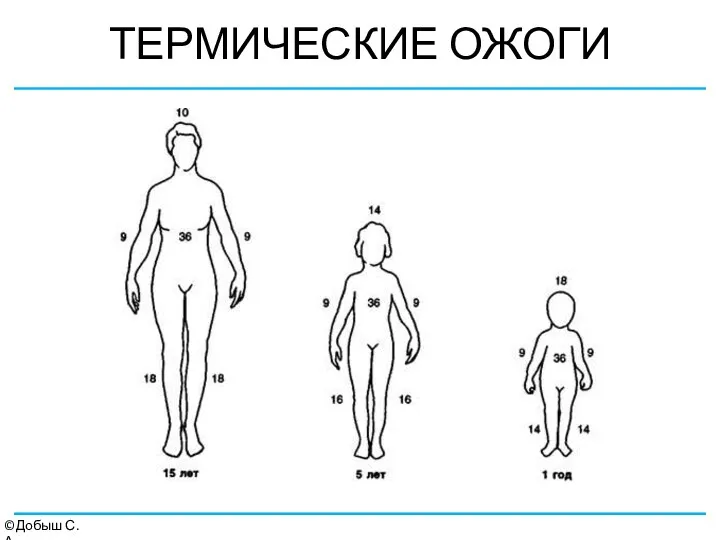 ТЕРМИЧЕСКИЕ ОЖОГИ ©Добыш С.А.