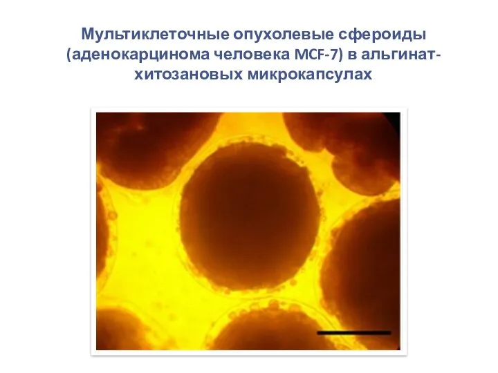 Мультиклеточные опухолевые сфероиды (аденокарцинома человека MCF-7) в альгинат-хитозановых микрокапсулах