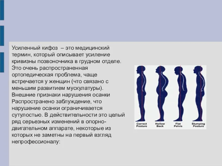 Усиленный кифоз – это медицинский термин, который описывает усиление кривизны